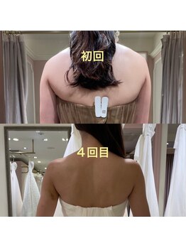 ディア スプリーマの写真/全国からブライダル予約殺到★花嫁様から圧倒的支持&ゴッドハンドに太鼓判!紹介多数!10万人越えの結果出し!