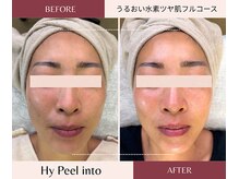 ルームエイトエイティスリー 新宿(R883)/Gloss肌で艶々に