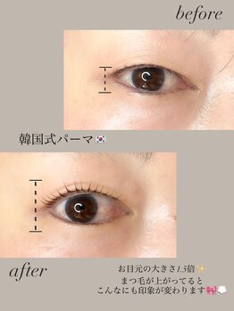 ノエル(Noel)/before after 担当なぎ