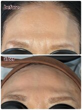 ケースタイル(k.style)/ハリツヤアップ