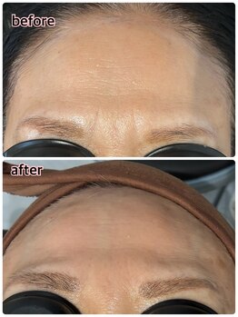 ケースタイル(k.style)/ハリツヤアップ