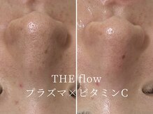 ザ フロウ(THE flow)/押し出ず分解！最新毛穴ケア