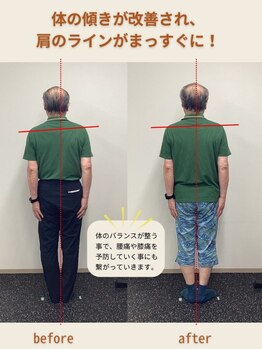 整体サロン Preava/姿勢の変化