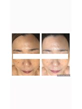 オアジスパ(Oasi Spa)/バイオセルショット65