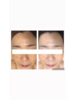 オアジスパ(Oasi Spa)/バイオセルショット65