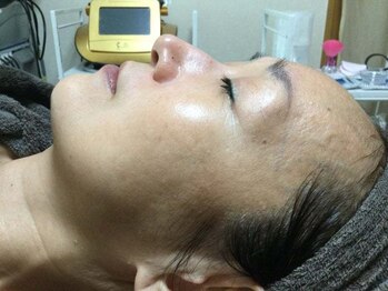 ノットノット 自由が丘(Not Knot)/１. グリーンピール 5days前
