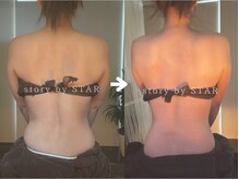 ストーリーバイスター(story by STAR)/ボディケア1回での変化