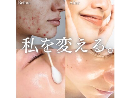 ニューリー(Newly.)の写真