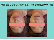 サロンビオーナ(SALON Biona)/極技ハンド小顔矯正
