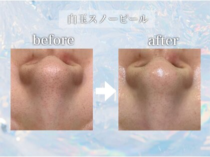 エステティック レイビス 池袋店(RAYVIS)の写真