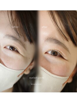 キルナノール 福岡天神(kiruna norr)/やさしさにぱっちりをプラス