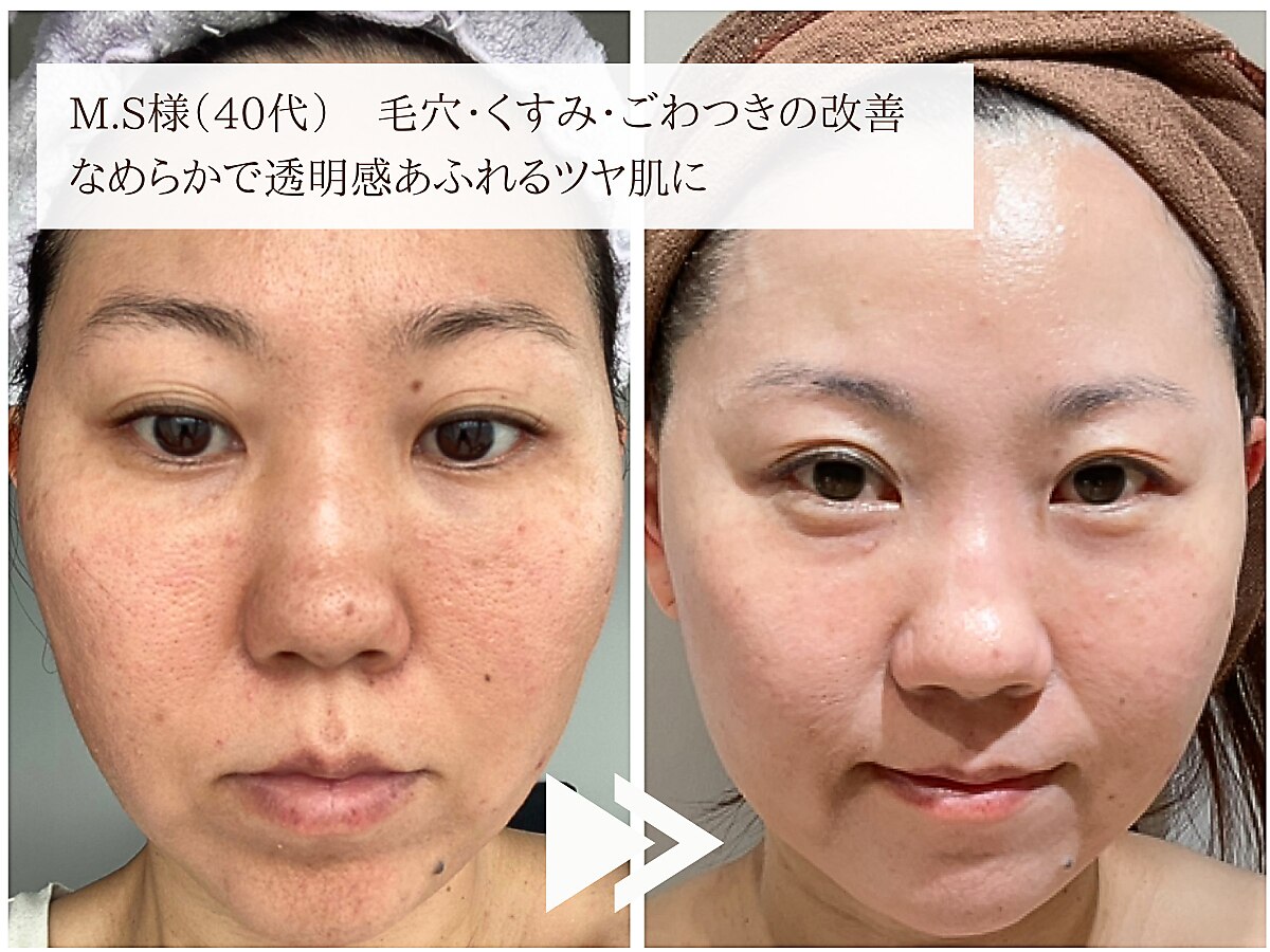 レイテノール vc 美容 液 リレント化粧品 ラ・セラールの通販