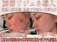 エステティック リオン(Rion)