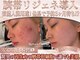 エステティック リオン(Rion)の写真