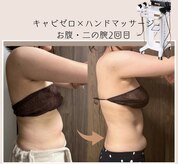 琴