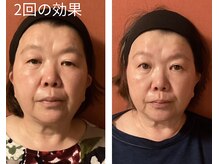 ロイヤリティ(ROYALTY)/目元の変化もみれます☆