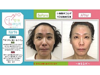小顔整体研究所 KSラボ 天王寺店/