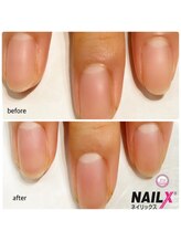ネイリックス 栄ガスビル(NAILX)/