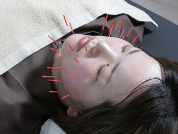 リンク 広島中区(Link)/施術風景