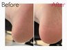 【ご新規様】 footワンカラー＋角質ケア¥11,800→¥9,800