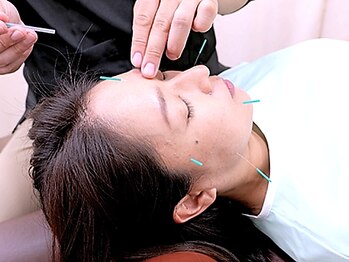 からくり整骨院の写真/首肩こりの不調を根本から改善し、美肌やリフトアップも叶える！話題の美容鍼をぜひ体験してください。
