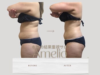 アメリオ(Amelio)/全身+キャビ90分　20代後半