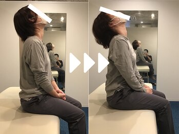 ミライズ整体院 三宮駅前院/事例【20代女性肩こり】