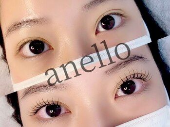 アネロ(anello)の写真/技術が高くモチが良い◎様々なロッドをご用意しているので、あなたの理想のデザインがきっと見つかる♪