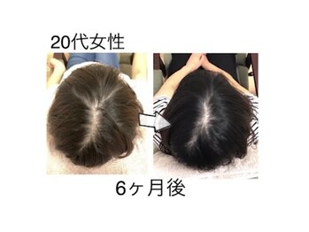 かがわ接骨院 高松伏石院/頭皮トラブルでお悩みの方へ！