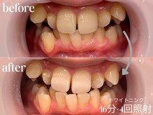 ホワイトニングカフェ 仙台八幡店/☆学生さんもお気軽に