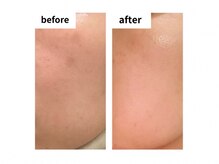 サロン シェリール(Salon Cherir)/ダクトピール　B/A