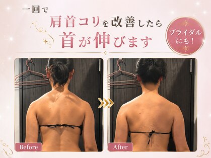 一花の写真