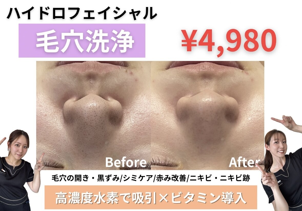 エクラ(ECLAT)｜ホットペッパービューティー