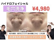 エクラ(ECLAT)