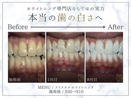 キラット 横浜店(Kiratt)の写真