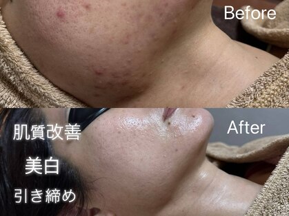 エシャーム(echarme)の写真