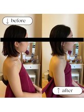 トータルビューティーサロンリア(Li'a)/ビフォー＆アフター