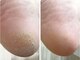 ユニコ(Unico)の写真/フットケア専門サロンで足裏まで美しく！！