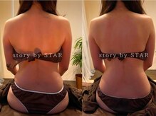 ストーリーバイスター(story by STAR)/ボディケア1回での変化