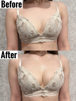 ノート(Naught)/大好評☆育乳バストケアメニュー