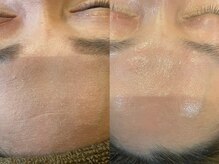 トトノエ(TOTONOE)/クリスティーナ -ビオフィート-