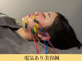 至福の空間 まごのて/【美容鍼】　電気あり