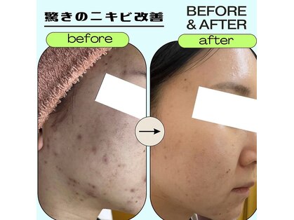 パールプラス 高山店(Pearl plus)の写真