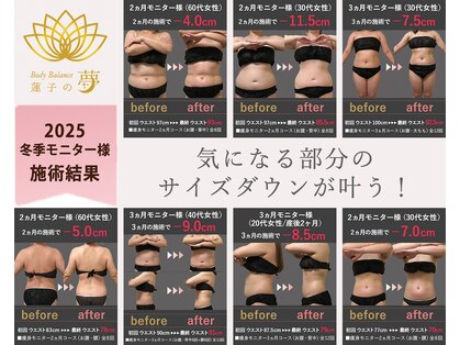 蓮子の夢の写真