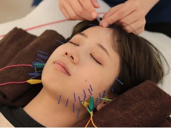 リニューサロン 本院(renew salon)の写真/【肌の内側からケアする美容鍼】お顔の悩み、解消したいあなたにおすすめ☆くすみやたるみを改善◎