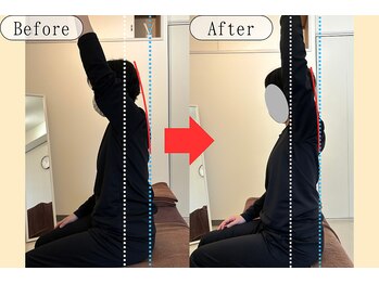 シェアハピネス たまプラーザ(share happiness)/Before＆After