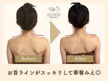 ラフリー 神戸三宮院(RUFFREE)/綺麗な首ラインでドレス映え確定