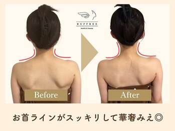 ラフリー 神戸三宮院(RUFFREE)/綺麗な首ラインでドレス映え確定