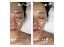 モア(MOA)の雰囲気（韓国最新★ララピール進化版を初導入。次世代肌管理はエリア初。）