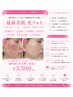 【肌質改善したい!全ての肌悩み/赤ら顔を改善したい】最新美肌 光フォト